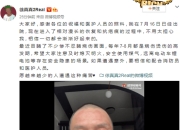 歌手徐真真出院报平安 曾因点蜡烛引火灾全身烧伤